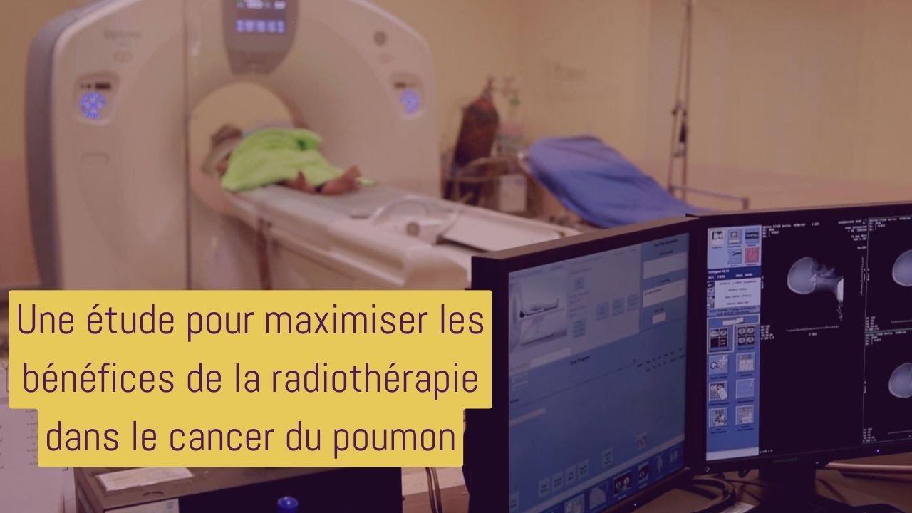 Publication d'une étude pour maximiser les bénéfices de la radiothérapie dans "The Lancet Oncology"